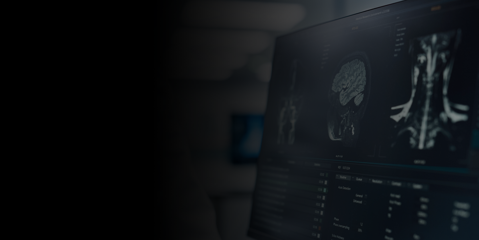 Long-Term Maintenance for imaging devices